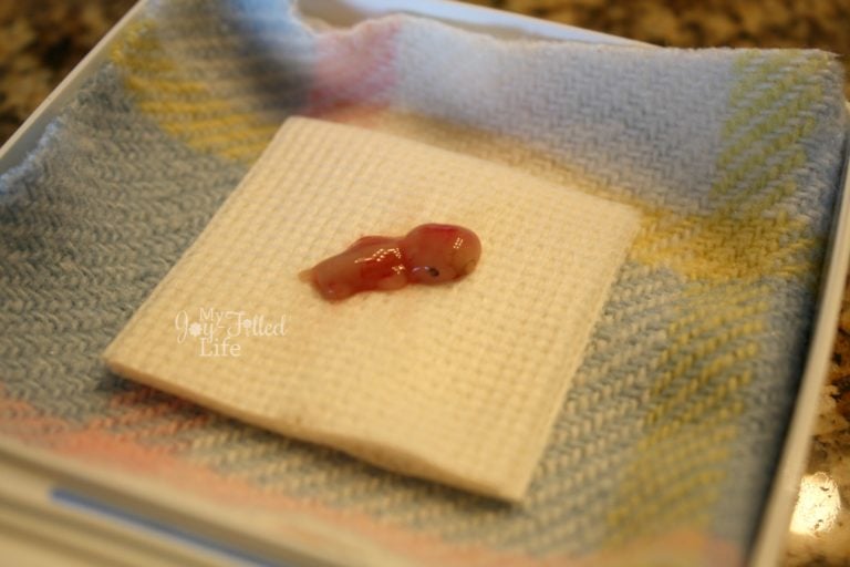 10 Ways to Honor Your Baby After Miscarriage or Infant Loss My Joy